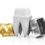 Ästhetische Zahnkronen aus Keramik – Zahnärzte Neustadt Passage für Ihren perfekten Biss